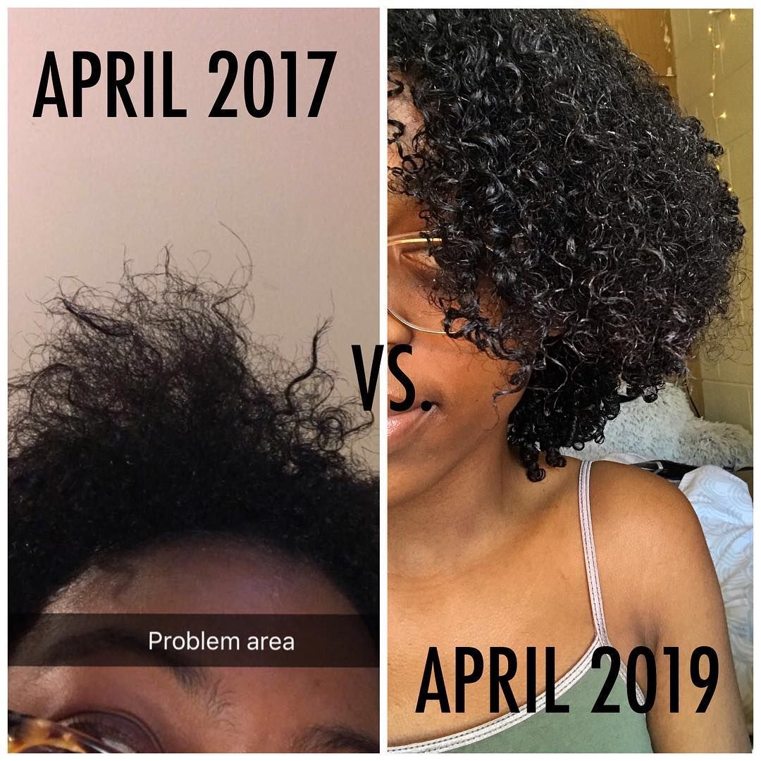 If You Want To Grow Long Hairs Really Fast Just Follow These 5 Steps Growing Long Hair Faster Make Hair Grow Faster Help Hair Grow