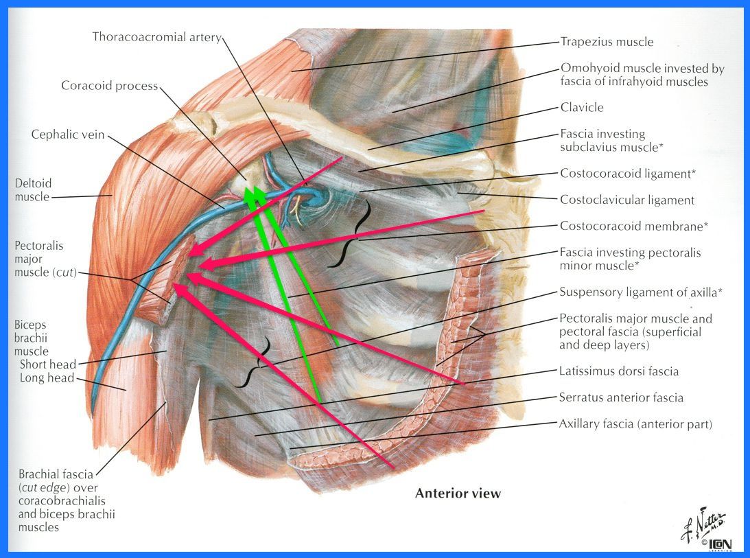 Pectoralis Spasm Due To Poor Posture Restore353 Poor Posture Pectoralis Spasm Due To Poor Posture Restore353 Poor Posture