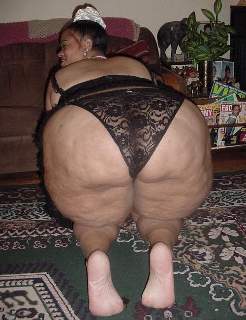 ass fat pantie Fibrocystic changes in the breast