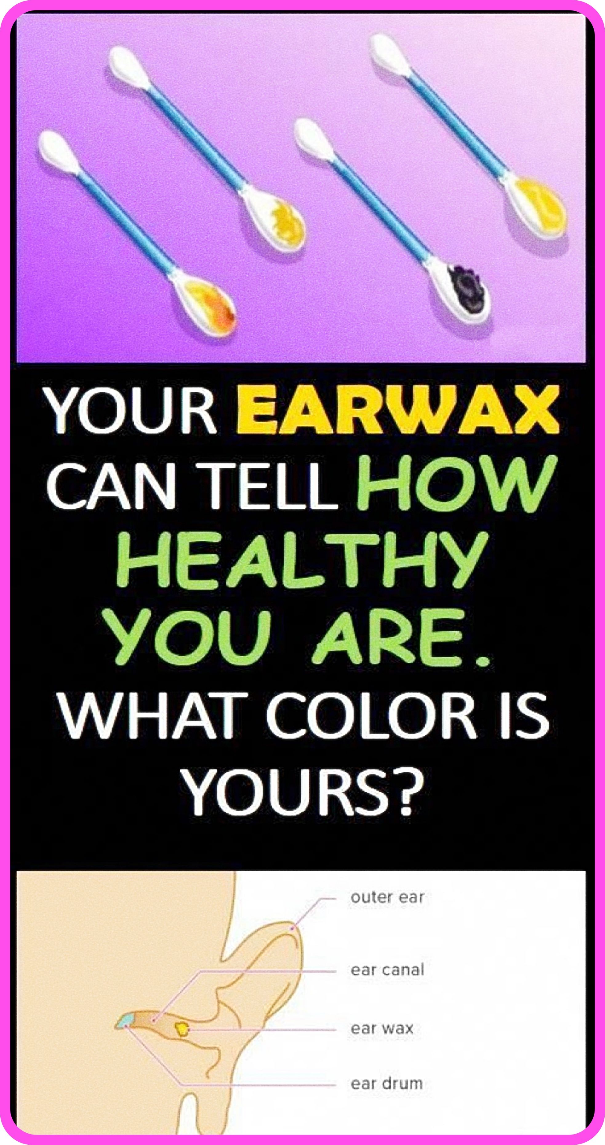 What Earwax Can Tell About Your Health What Earwax Can Tell About Your Health