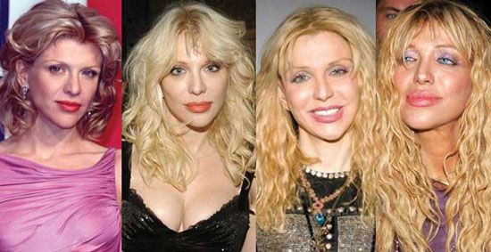 free courtney love plastic surgery