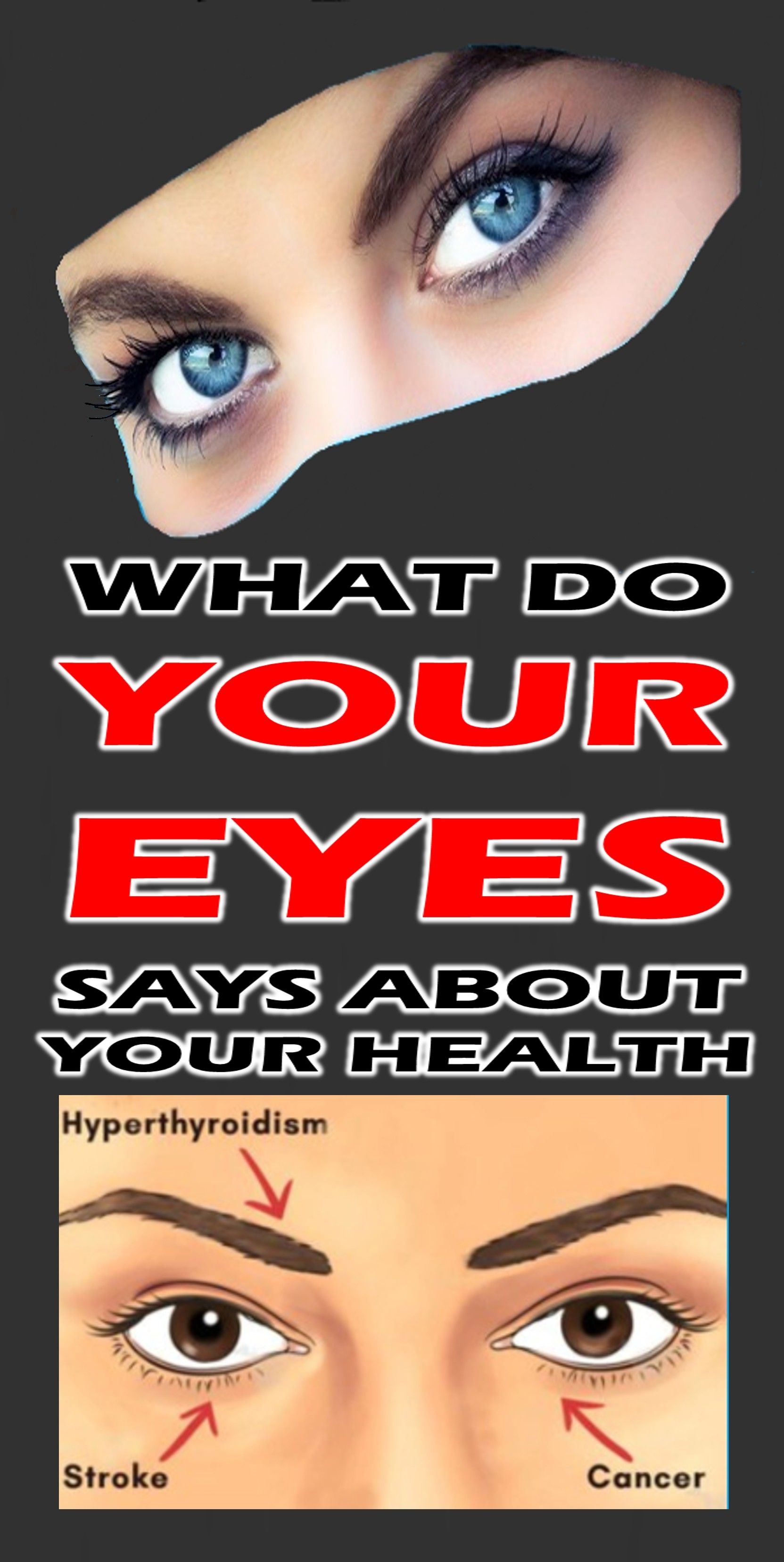 Your Eyes Are Windows to Your Stroke Risk photo Your Eyes Are Windows to Your Stroke Risk photo