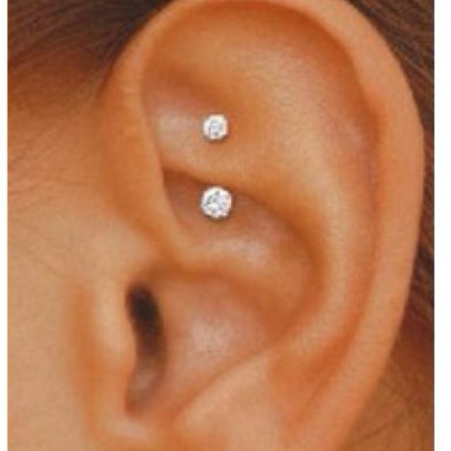 Daith Piercing Infection Img3 Daith Piercing Infection Daith Piercing Infected Ear Piercing