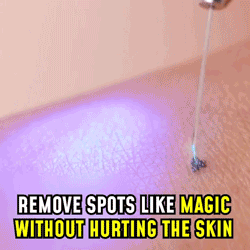 Instant Spots Removal Pen FREE SHIPPING - hoglam2020 | Best dark spot remover, Skin spot remover, Body dark spots