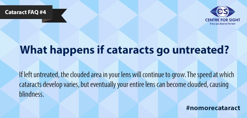 Pin on Cataract services
