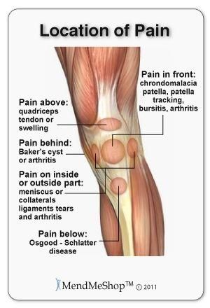 lábízületbetegség bursitis