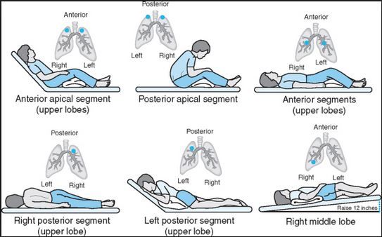 Postural drainage