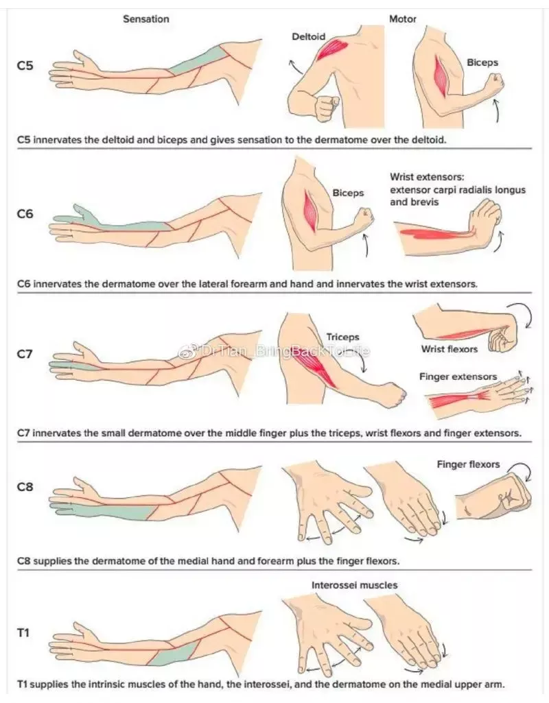 Patrones de los síntomas de la hernia discal cervical Physical Therapy Student, Occupational Therapy Activities, Physical Therapy Exercises, Orthopedic Physical Therapy, Human Body Anatomy, Human Anatomy And Physiology, Muscle Anatomy, Medical Anatomy, Massage Therapy