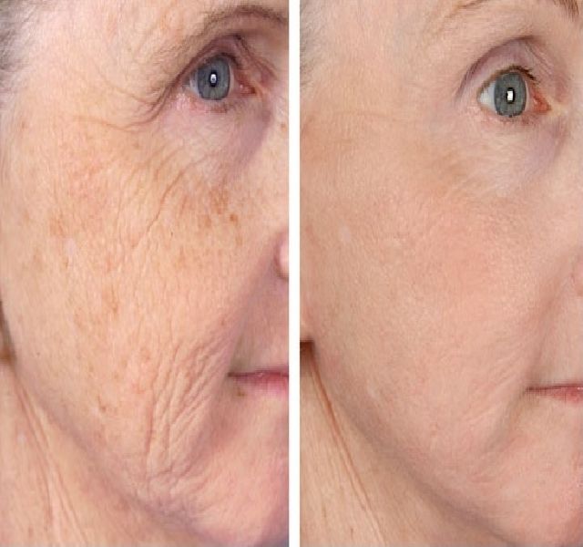 bonvillars svájci anti aging