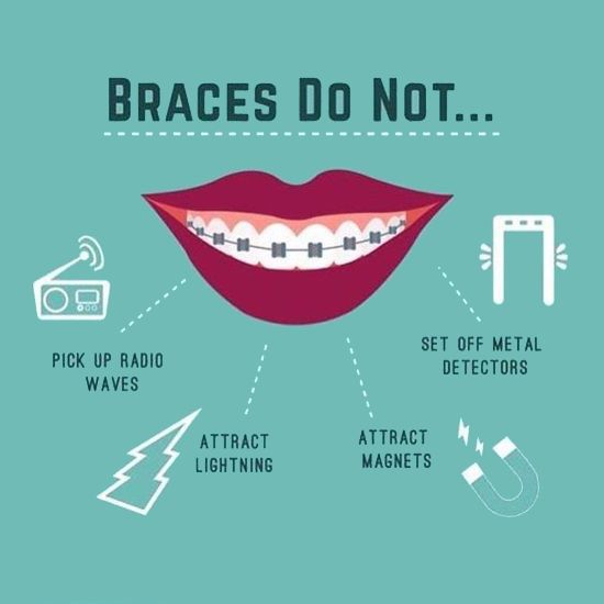 Today is NationalRadioDay Braces may look like a radio antenna but