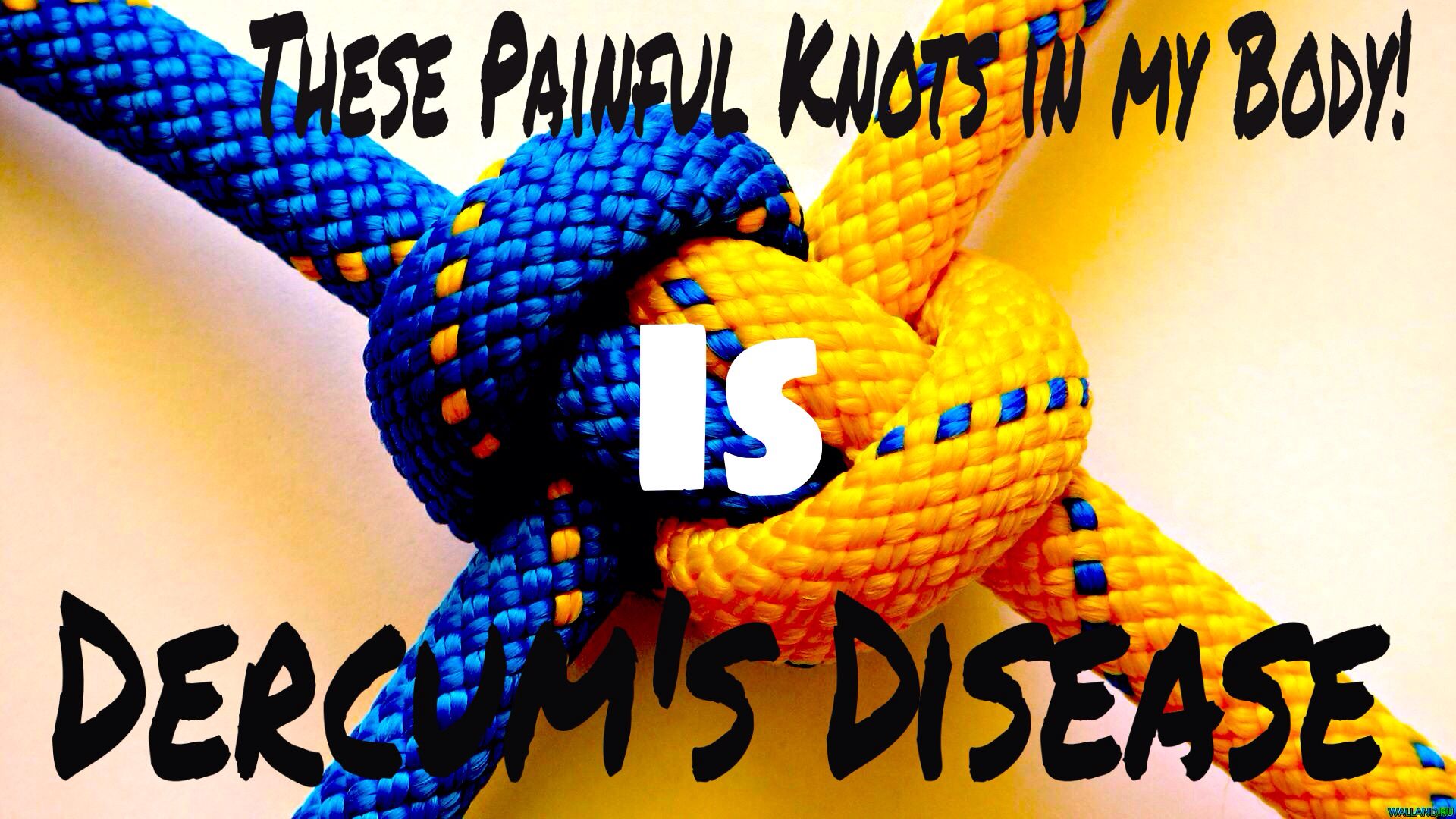 Dercum's disease | Disease awareness, Dercums disease, Awareness ribbons
