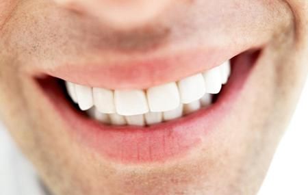 blanquear los dientes en forma casera