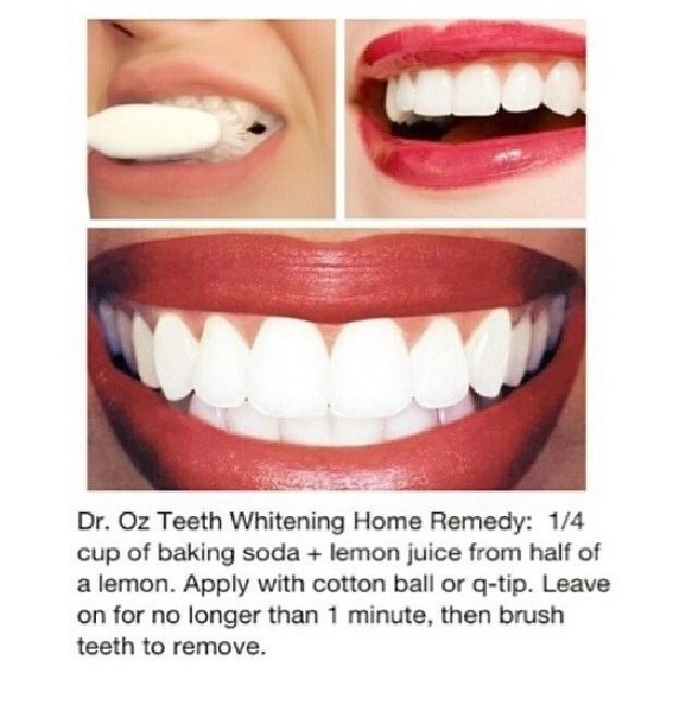 Whiten Your Teeth Without Having To Bleach (With images ...