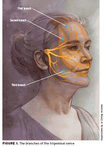 Facial paralysis and neuralgia photo 550