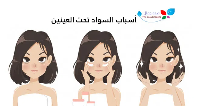 أسباب السواد تحت العينين كيف يمكن علاجها وماهي دلالاتها الخطيرة Sehajmal Beauty Disney Princess Disney Characters