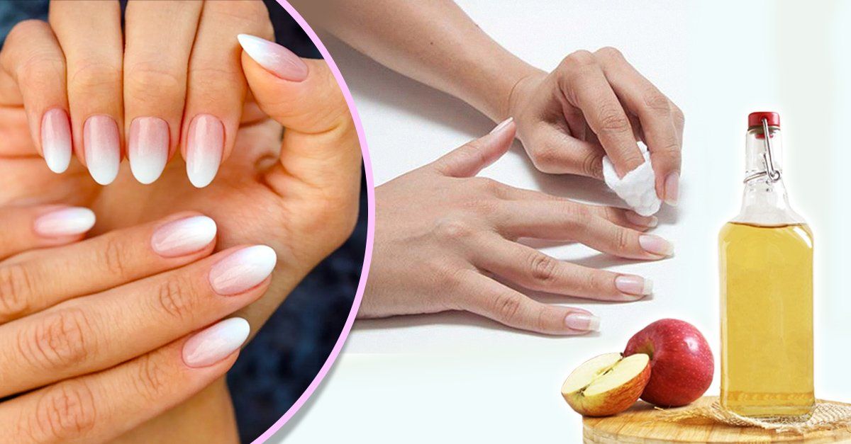 El Vinagre De Manzana Ayuda A Fortalecer Las Uñas Y Tenerlas Bonitas Vinagre De Manzana Las Uñas Manicura