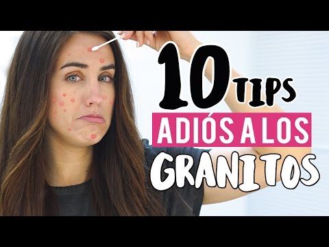 Crema para granos en la cara casera