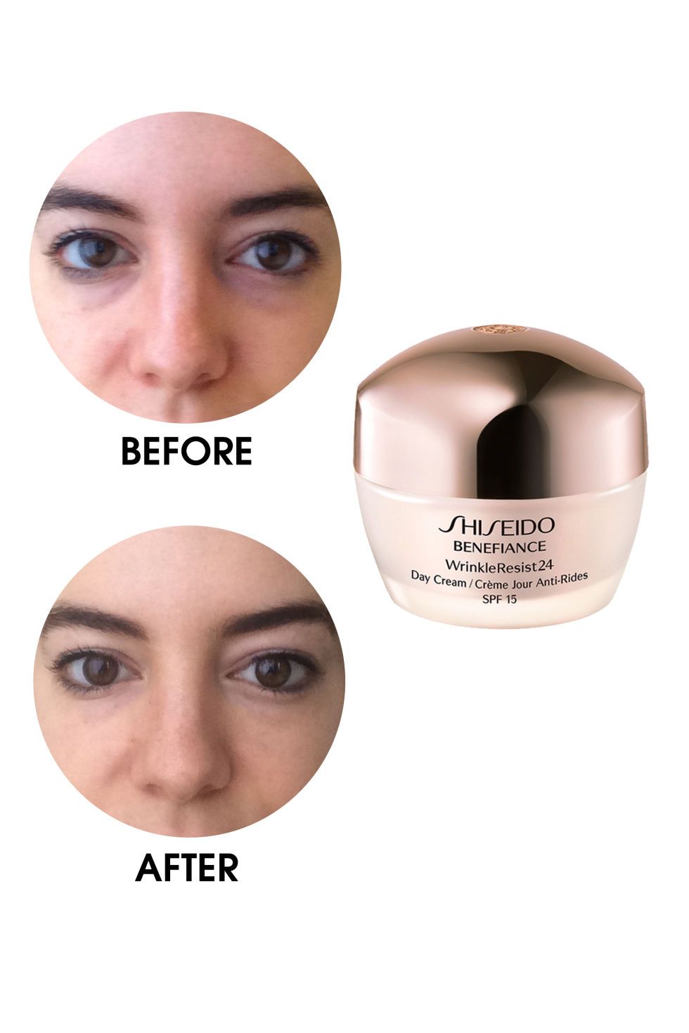 Best Remedies For Under Eye Bags Testing Best Products And Treatments For Under Eye Bags And Circles Eye Treatments Eye Bags Treatment Eyeliner Products
