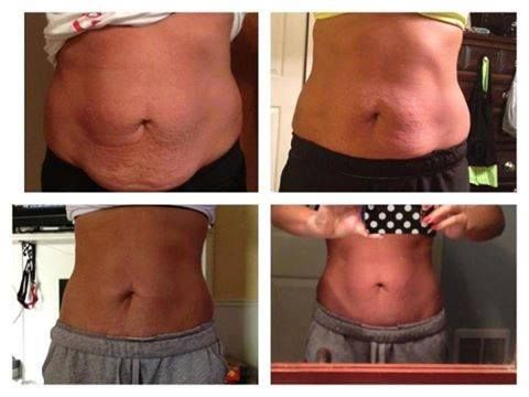 20 kg weight loss in 15 days picture 6