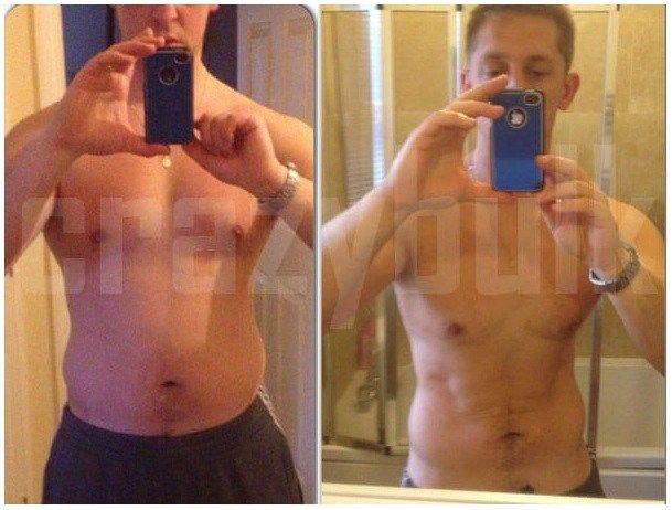 Weight loss surgery shelton ct picture 8