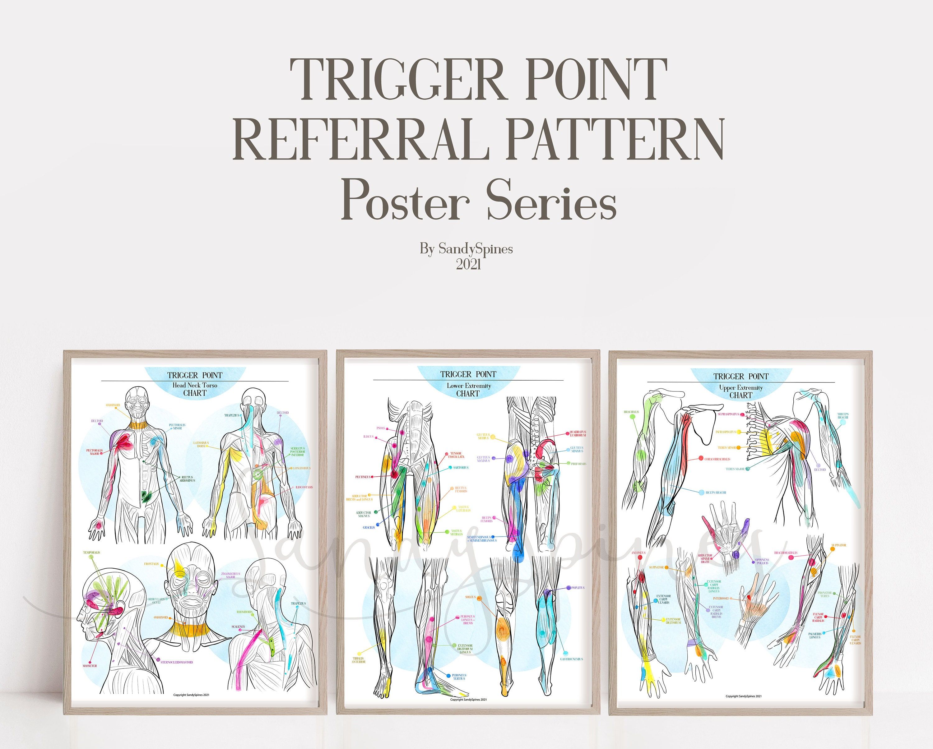 Muscle Trigger Point Charts Set of 3 Art for - Etsy | Trigger points