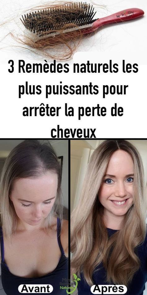 La perte de cheveux peut être très complexant cependant si ... La perte de cheveux peut être très complexant cependant si ...