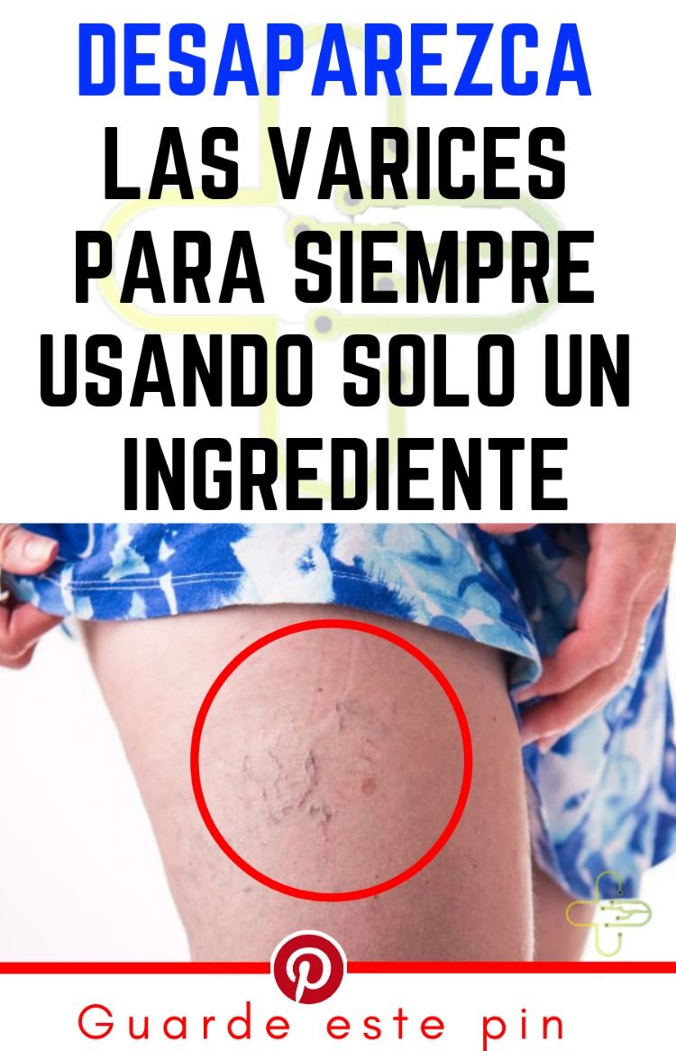 ejercicios para prostatitis sin maquillaje ejercicios para prostatitis sin maquillaje