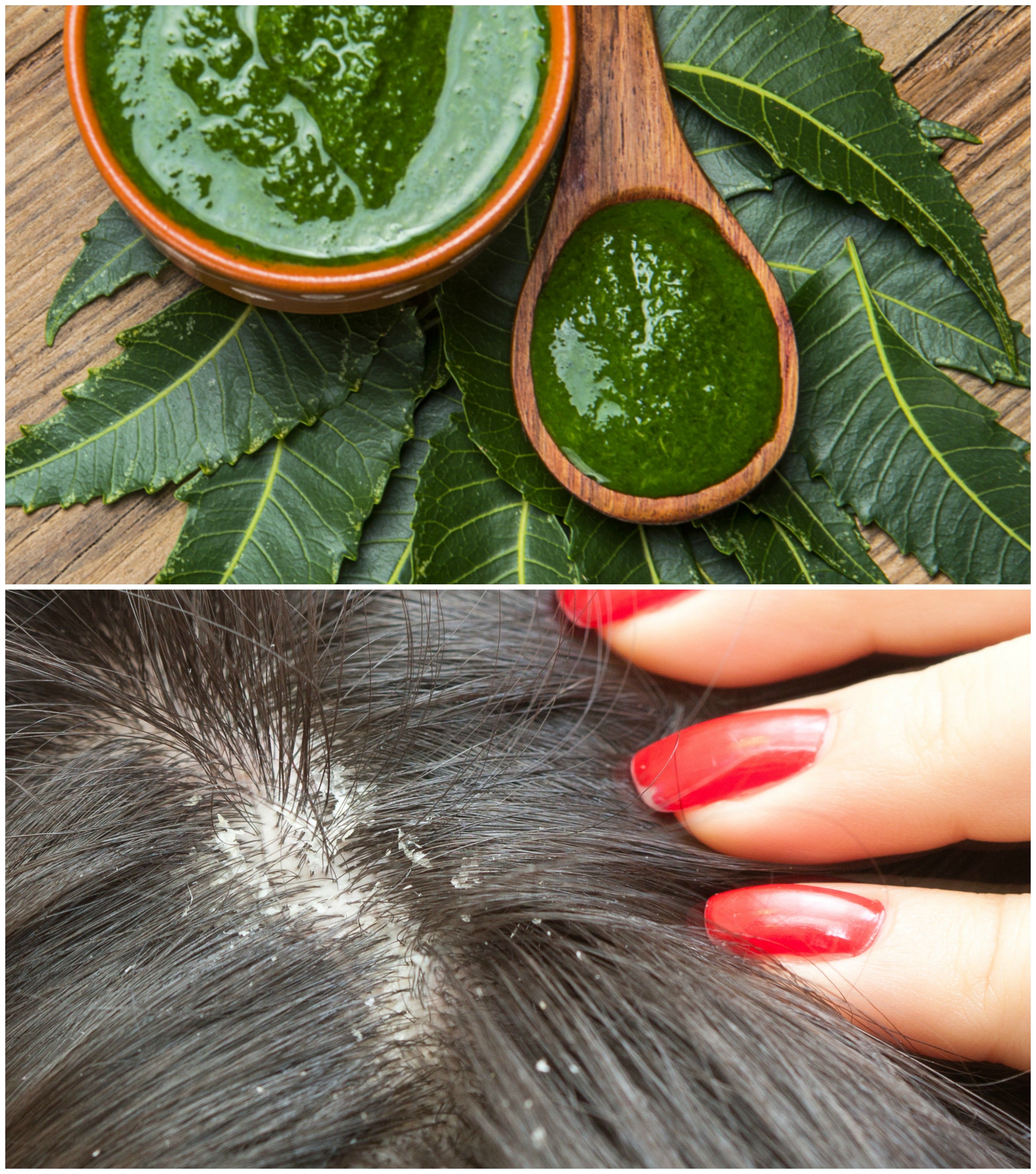 How To Grow Hair Faster Best Hair Loss Balding Treatment Grow hair