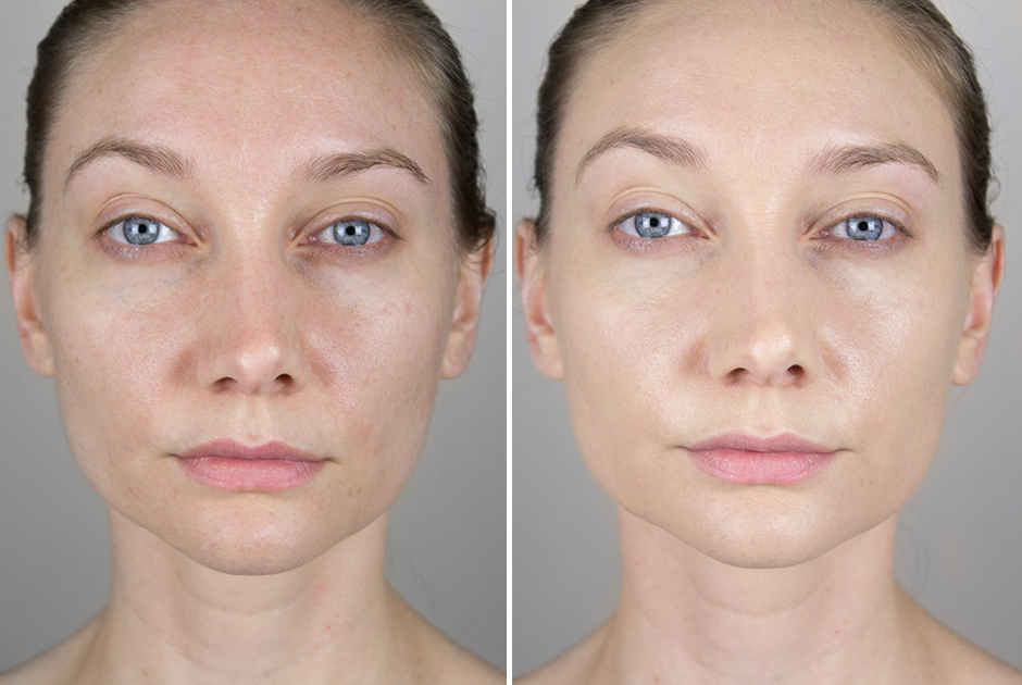 Buy ivermectin for humans over the counter Buy ivermectin for humans over the counter