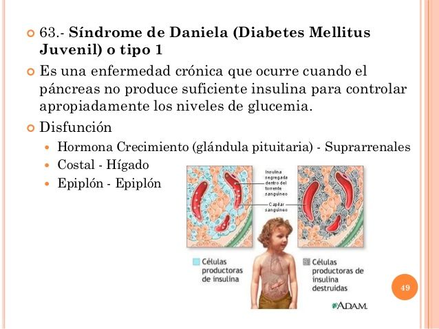 Pares De Acuerdo A Padecimientos Biomagnetismo Enfermedades Crónica Acupuntura Puntos Diabetes