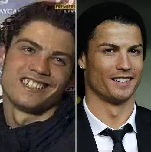 15 celebridades antes e depois de serem contaminadas pelo rycka vírus Celebrity Teeth, Celebrity Smiles, Celebrity Gossip, Celebrities Before And After, Celebrities Then And Now, Favorite Celebrities, Liam Hemsworth, Cristiano Ronaldo, Shakira