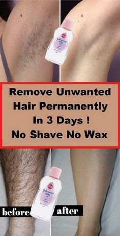 Remove Unwanted Hair Permanently In Three Days , N Remove Unwanted Hair Permanently In Three Days , N