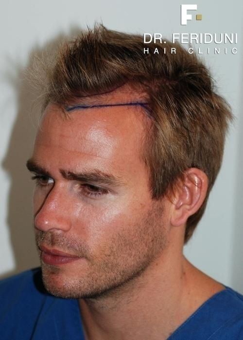 Top Frisuren, Frisuren Trend, Frisuren Dünnes Haar, Neue Frisuren, Herren Frisuren Top Frisuren, Frisuren Trend, Frisuren Dünnes Haar, Neue Frisuren, Herren Frisuren