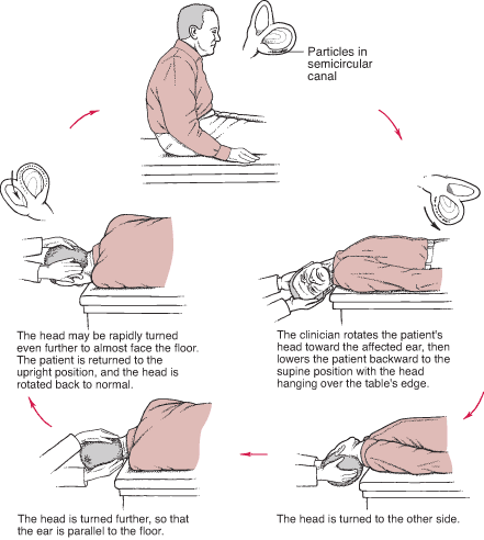 vestibular therapy near me dizziness vertigo treatment specific head positions vestibular therapy near me dizziness vertigo treatment specific head positions