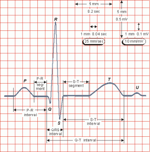 Rutina De Interpretación De Un Ecg Cardiología Cosas De Enfermeria Enfermería Farmacología