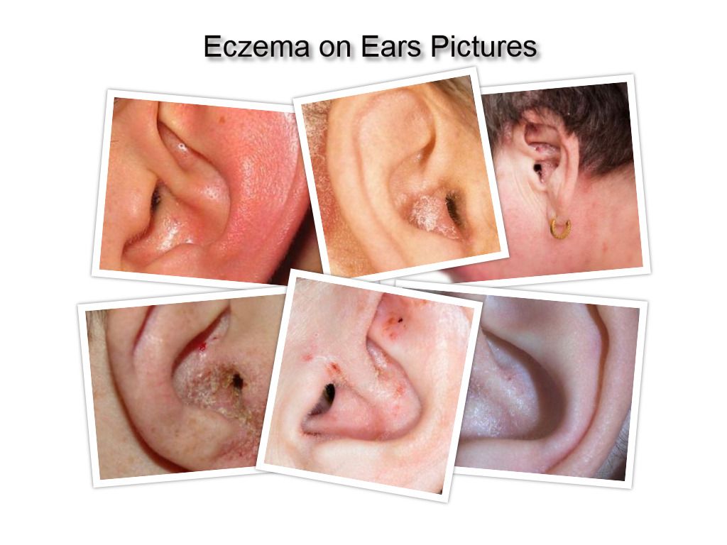 inner ear itch treatment inner ear itch treatment
