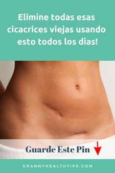 quitar cicatrices de acne viejas