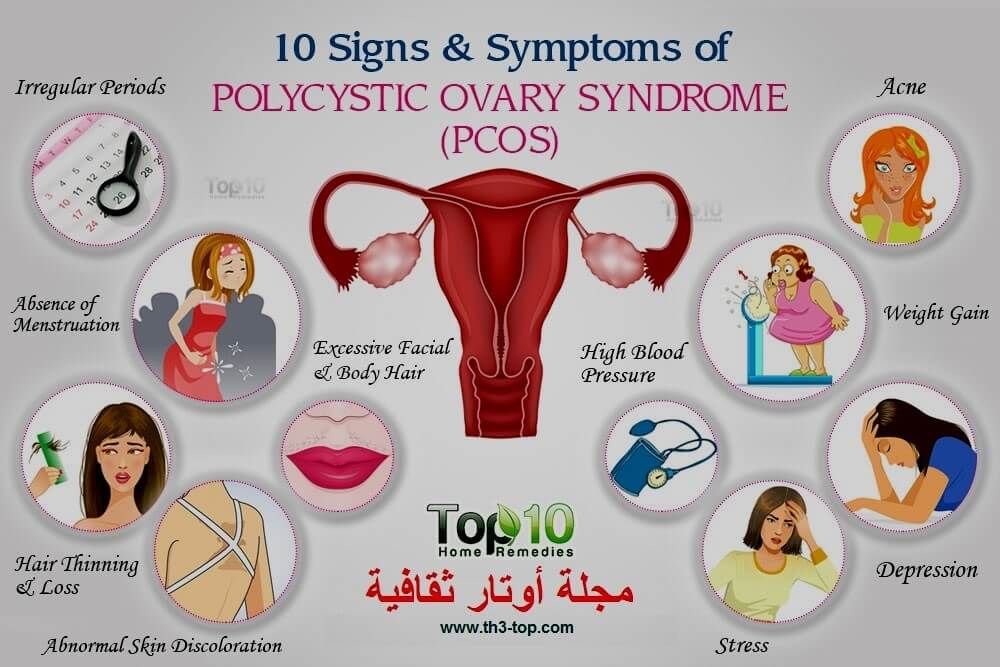 طرق ووسائل سحرية في علاج تكيس المبايض مجلة أوتار ثقافية Pcos Polycystic Ovary Syndrome Polycystic Ovary Syndrome Pcos