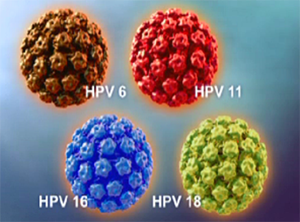 Human papilloma virus on babies. Human papilloma virus on babies - Human papilloma virus on babies