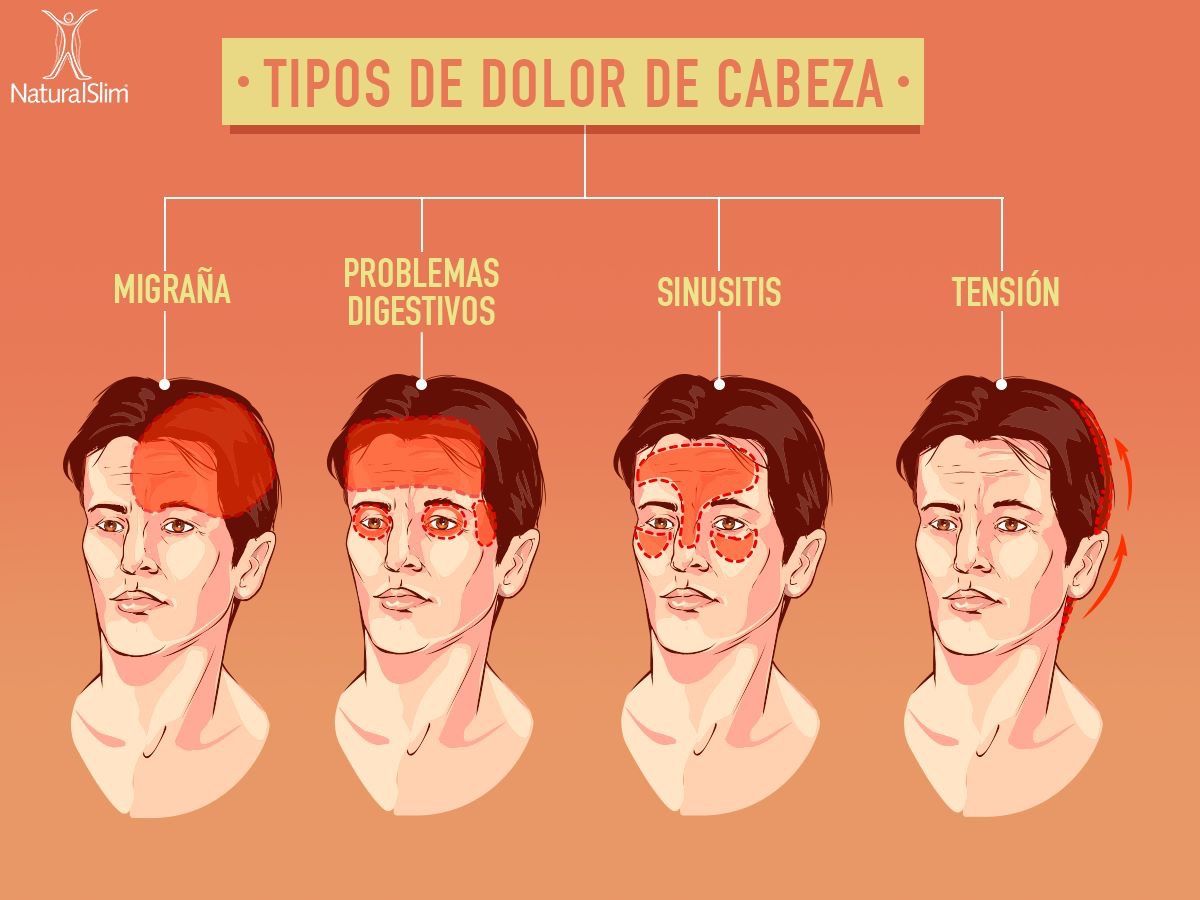 Tipos De Dolor De Cabeza Tipos De Dolor De Cabeza Dolor De Cabeza Dolor