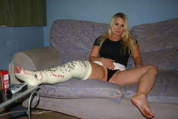 Being in a cast fetish photos 413