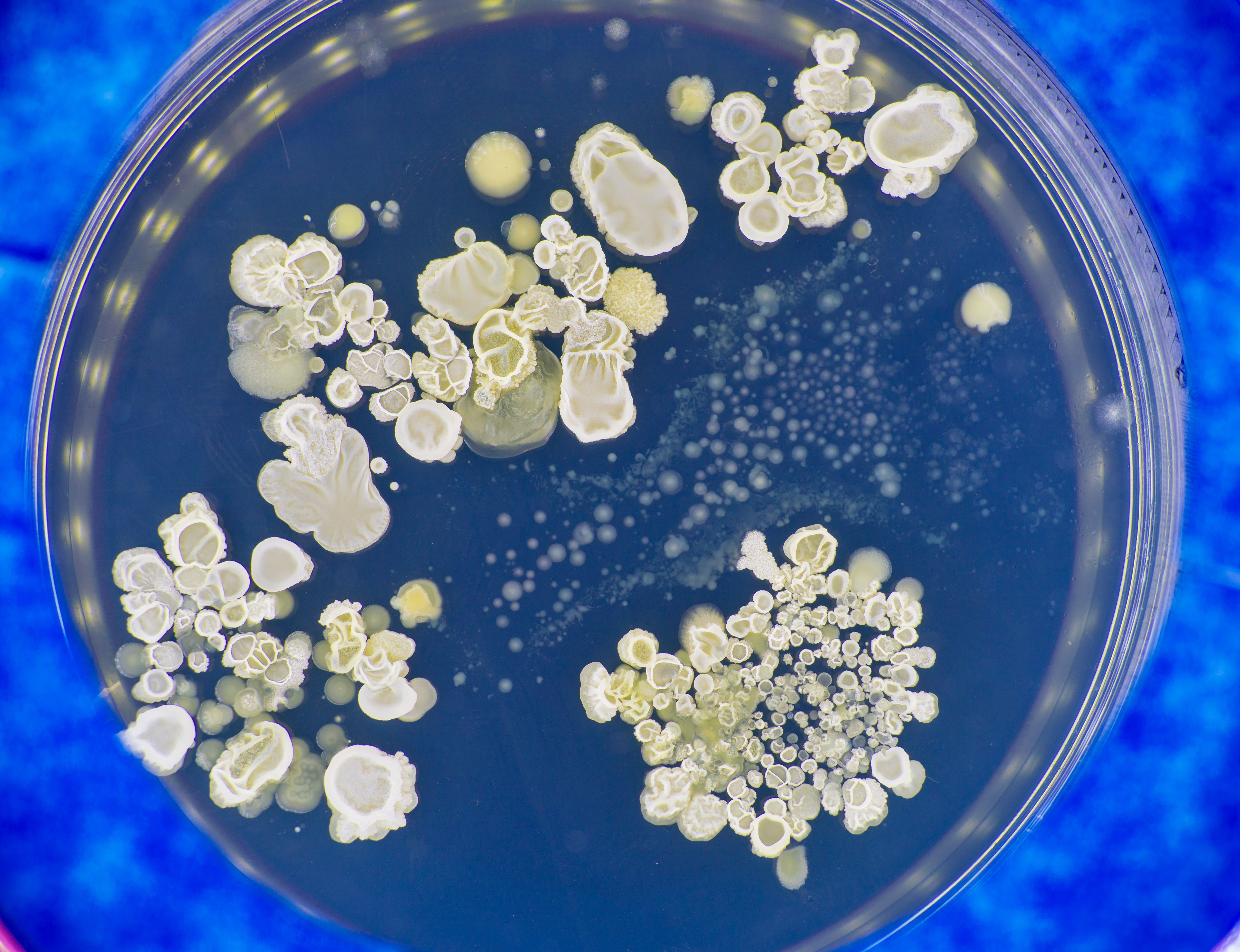 Combattre les infections fongiques avec des métaux, c’est la piste documentée par cette équipe de chimistes de l’Université de Berne, dans le Journal de l’American Chemical Society (JACS) Au, avec un énorme potentiel à la clé. Berne, Journal, American, Mushroom, Runway