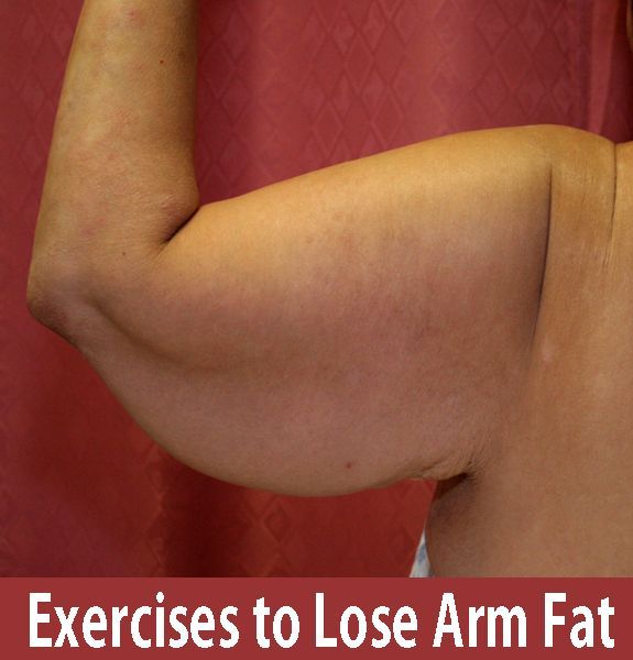 Weight loss centers fort lauderdale photo 5