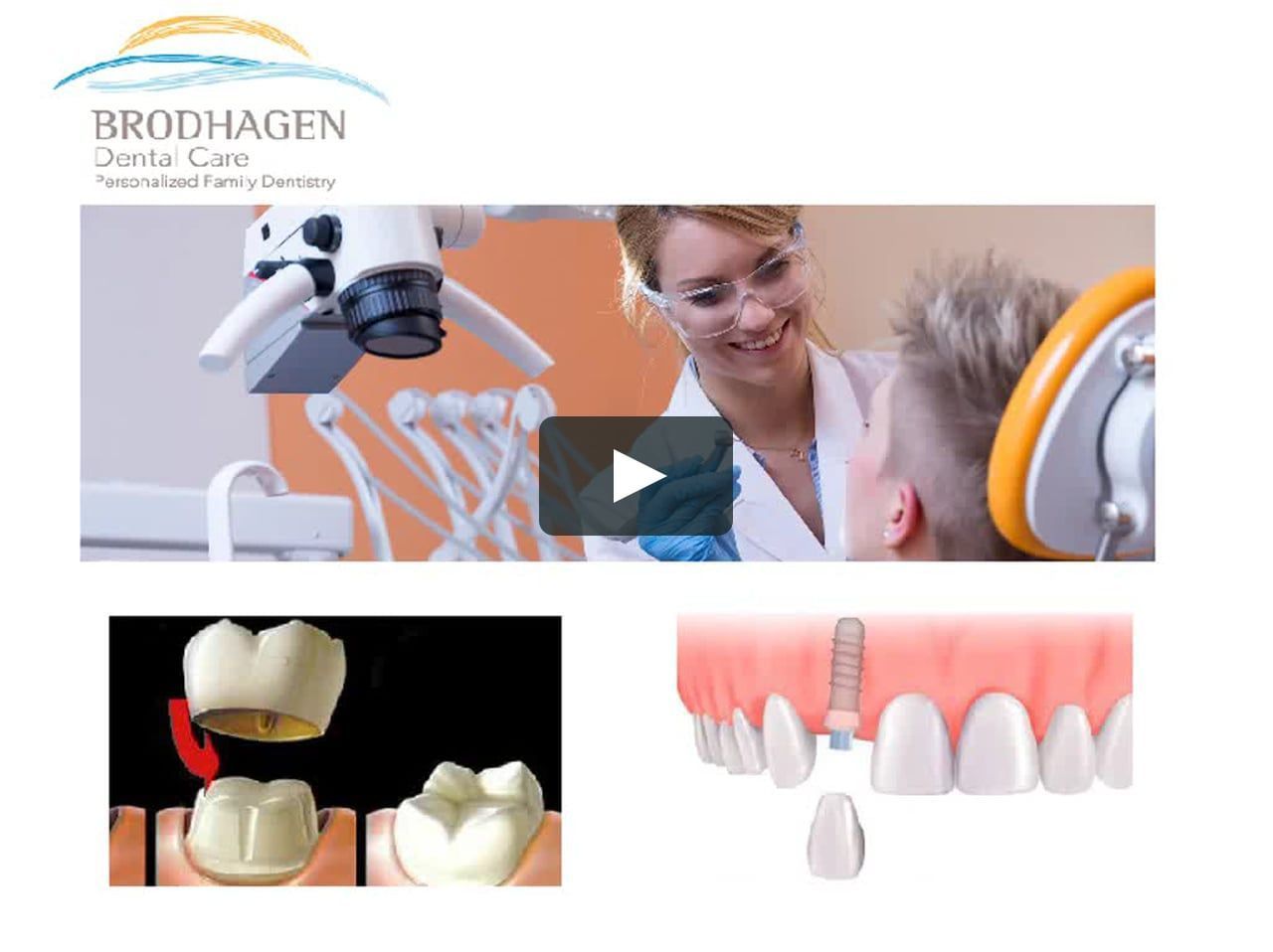 Five Dental Crowns Before And After Life Tooth Dentalcrownporcelain Cure For Sleep Apnea Dental Care Dental