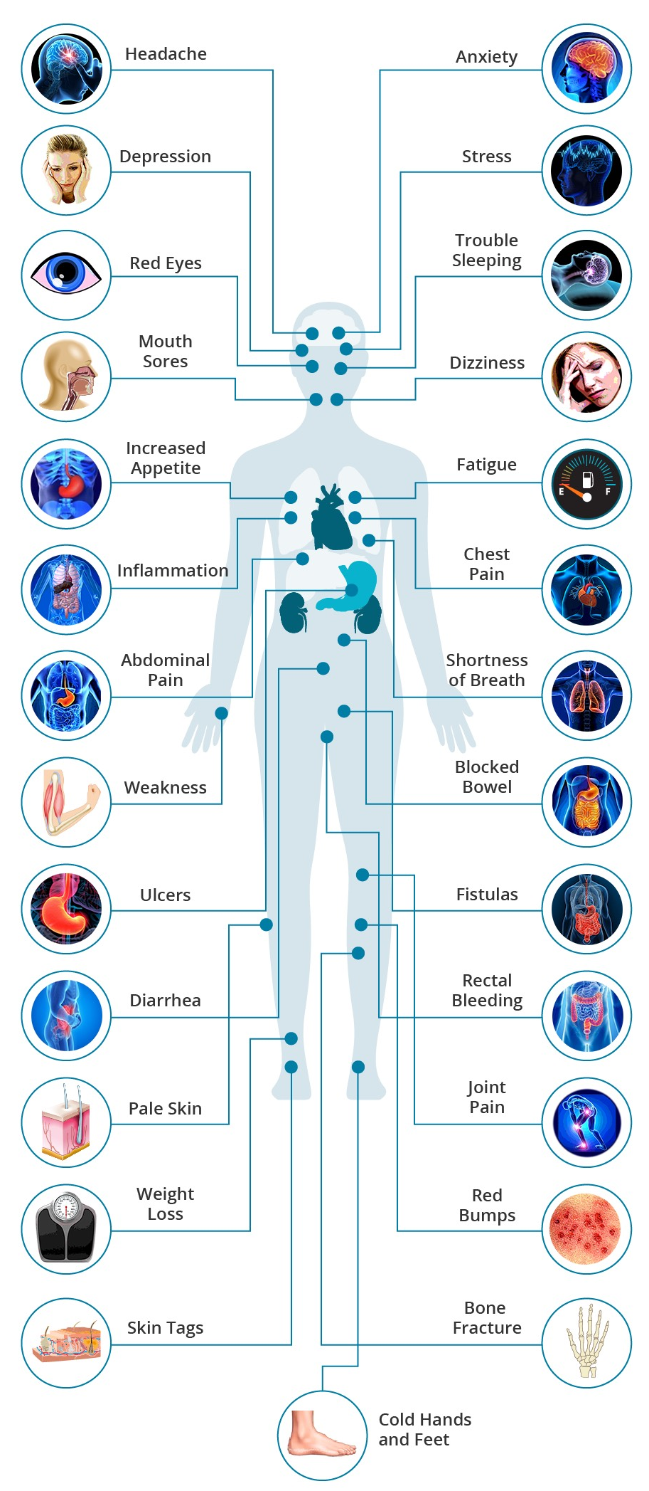 What are the Effects of Crohns Disease on the Body?