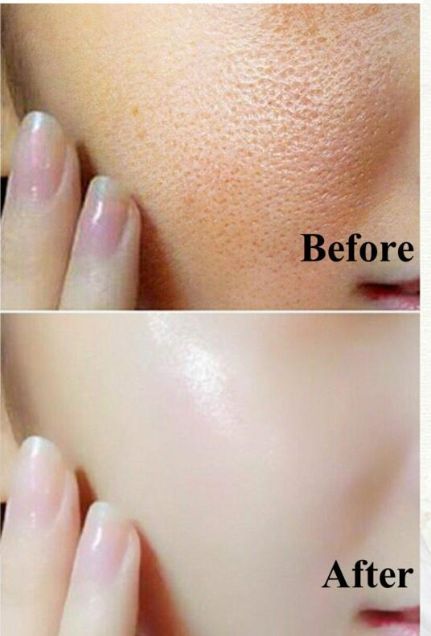 4 Face Cleansers For Normal And Combination Skin : 4 Face Cleansers For Normal And Combination Skin :
