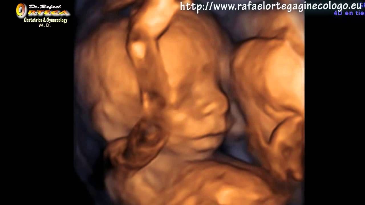 Pin En Pregnant Ultrasound