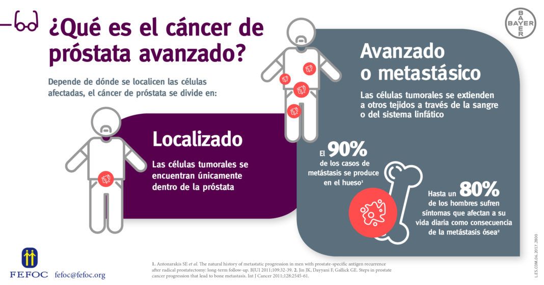 sintomas de cancer prostate avanzado