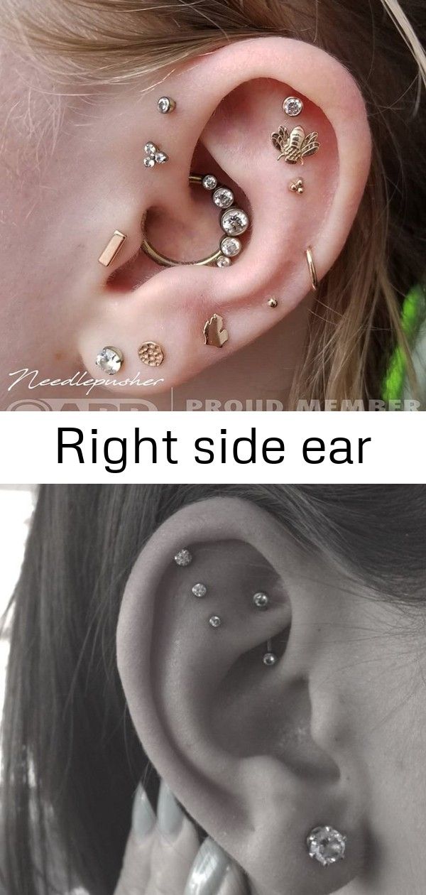 Right side ear