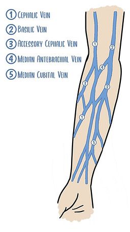 10 IV Insertion Tips for Nurses